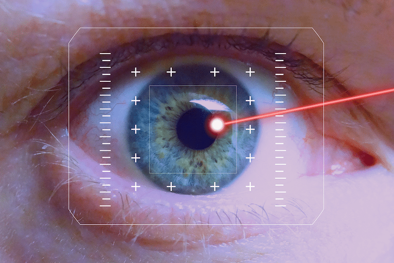 Chirurgie yeux au laser